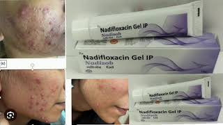 Nadizob Geil Nadifloxacin Gel IP [upl. by Annawyt640]