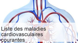 Maladies du système cardiovasculaire  liste causes et symptômes des pathologies [upl. by Einnij966]