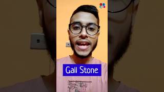 Gall bladder stone  Acute cholecystitis  Treatment  Surgery  Dr Med Sakib Rahaman [upl. by Vey]