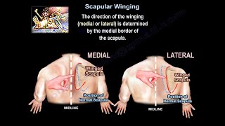 Scapular Winging  Everything You Need To Know  Dr Nabil Ebraheim [upl. by Dnalevets]