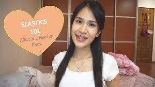 Braces Update 2 years 2 months and Elastics 101 How Do They Work [upl. by Sherwynd]