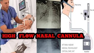 HIGH FLOW NASAL CANNULAHFNC TYPE 1 RESPIRATORY FAILUREADVANTAGEDISADVANTAGES BENGAL LANGUAGE [upl. by Irmina468]