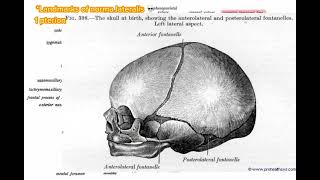 Pterion norma lateralis anatomy skull headandneckanatomy [upl. by Kussell]