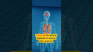 Treatment Options for Glioma Including Homeopathy [upl. by Hogarth]