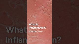 What is Inflammation [upl. by Phipps294]