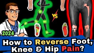 How To Reverse Foot Knee amp Hip Pain with Orthotics amp Insoles FAST [upl. by Rimaj77]