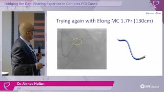 Role of Microcatheter when and how  Dr Ahmed Hailan [upl. by Aniale325]