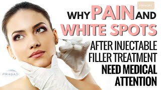 Why Pain and White Spots after Injectable Filler Treatment Need Medical Attention [upl. by Sineray531]