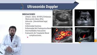 Imagenología del Sistema Genitourinario [upl. by Norraj]