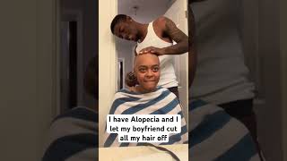 alopecia alopeciaawareness baldwomen bigchop hairtransformation bald [upl. by Noirad]