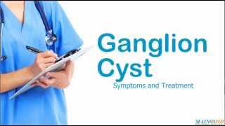 Ganglion Cyst Symptoms and Treatment [upl. by Airbmak624]