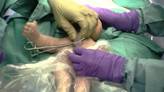 Delayed Cord Clamping [upl. by Alleira]