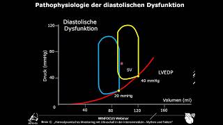 WINFOCUS Webinar  Linksventrikuläre diastolische Dysfunktion in der Intensivmedizin [upl. by Nnaeirelav997]