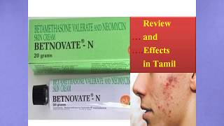 Betnovate N Face Cream Review And Side Effects in Tamil [upl. by Otiv730]