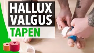 Hallux Valgus Tapen Anleitung  Zeh tapen Anleitung  Bodytape  Taping [upl. by Ailekahs384]