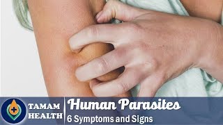 6 Symptoms of Human Parasites Everyone Should Know [upl. by Warenne545]