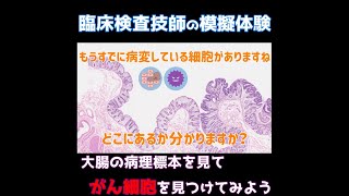 病理標本から「がん細胞」を見つける方法 [upl. by Ardnuhsor848]