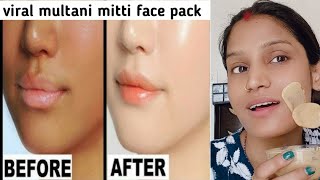 multani mitti face pack  viral multani mitti face pack for skin whitening  glowing skin face pack [upl. by Ahsieat347]