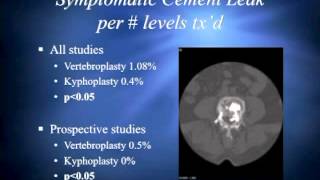 Vertebroplasty Revisited [upl. by Trent]