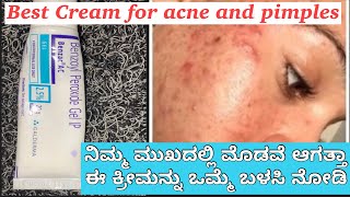 Benzoyl Peroxide Gel 25  Uses Side Effect Full Review In Kannada ಮೊಡವೆಯನ್ನು ಮುಕ್ತ ಗೊಳಿಸುವ ಕ್ರೀಮ್ [upl. by Cornelia]