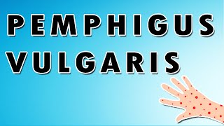 Pemphigus Vulgaris Symptoms Treatment and Causes [upl. by Elleirad]