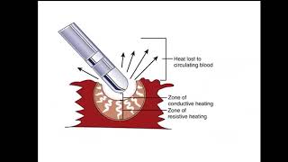 Basic Electrophysiological Study Dr Sherif Altoukhy [upl. by Namus]