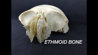 ETHMOID BONE [upl. by Ahsienyt833]