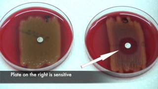 Bacitracin test for Streptococcus pyogenes [upl. by Yesor]