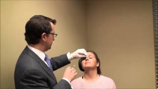 NonSurgical Nose Job  Dr Alex Donath [upl. by Silvio]