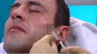 ITV Live Sculptra Treatment for Male Patient with Facial Fat Loss [upl. by Adnarym223]