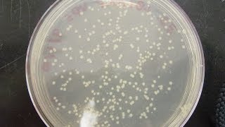 CFU Colony Forming Unit amp cfuml calculation [upl. by Mchail]