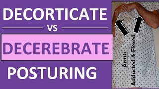 Decerebrate vs Decorticate Posturing Rigidity Mnemonic amp Pictures Nursing NCLEX [upl. by Pollux]