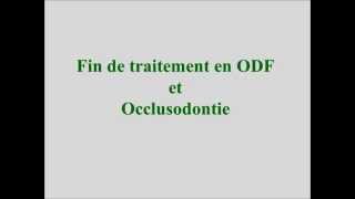 Orthodontie occlusodontie  fin de traitement version intégrale [upl. by Enelec66]