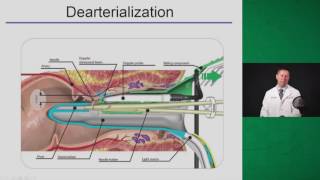 Logical Approach to Benign Anorectal Disease [upl. by Kinney]