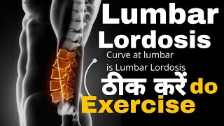 What is the fastest way to fix lumbar lordosisloss of lumbar lordosis exerciselordosislumbarspine [upl. by Yrag]