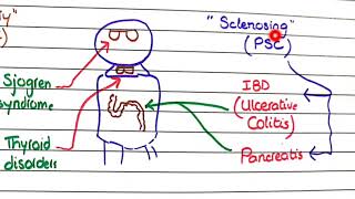 Primary Biliary Cholangitis and Primary Sclerosing Cholangitis  Pathology [upl. by Saunderson]