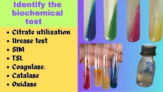 Biochemical Test  Bacterial Identification Technique Microbiology Practical Exam bacteriology [upl. by Enyawad318]