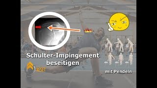 SchulterImpingement beseitigen  DIE Übung für schnelle Fortschritte [upl. by Bekki]