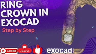 How to design a bridge with ring in exocad smiledesign exocad shorts digitalsmiledesign [upl. by Giana]