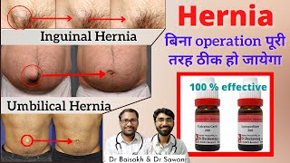 Homeopathic medicine for hernia hernia cure without surgery  hernia ka jad se ilaj [upl. by Flaherty]