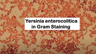 Gram Negative Rods of Yersinia enterocolitica [upl. by Enilegna]