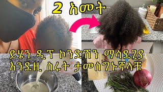 ይሄን ￼ምርጥ የፀጉር ትሪትመንት ስሩና ተጠቀሙበት ለሚነቀል ለሳሳ ለሚረግፍ ለልስላሴ ለወዙhome made hair growth￼ deep condition [upl. by Nawk]