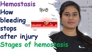 Hemostasis  Stages  Vasospasm  Clot Retraction amp Repair  Clotting of Blood  Breakdown of Clot [upl. by Trilley65]