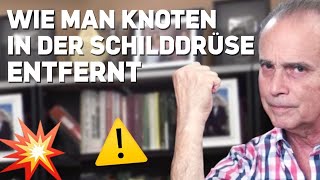 1100 Das Ende der Schilddrüsenknoten [upl. by Sowell49]