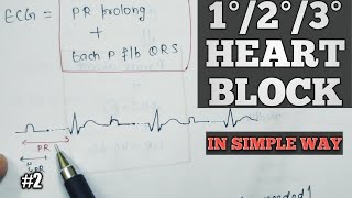 FirstsecondThird degree heart block  Cardiac arrhythmia in hindi  Av block  2 [upl. by Aenitsirhc]