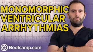 Monomorphic Ventricular Tachycardia  HIGHYIELD CARDIOLOGY  USMLE STEP 1 [upl. by Fair]