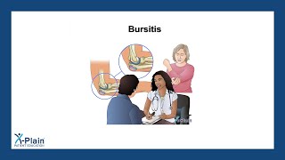 Bursitis [upl. by Ainavi]