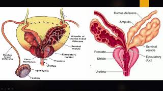 ULTRASOUND SPERMATIC CORD FUNICULITIS [upl. by Vorster578]