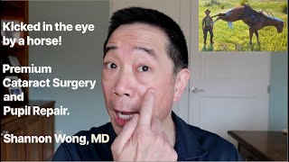 Kicked in the eye by a horse Pupil repair and premium cataract surgery Shannon Wong MD [upl. by Haim]