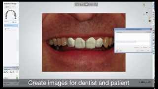 Dental System 2013  RealView Engine™ with 2D Image Overlay [upl. by Earesed]